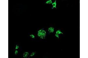 Image no. 3 for anti-Cytidine Monophosphate (UMP-CMP) Kinase 1, Cytosolic (CMPK1) antibody (ABIN1497544) (Cytidine Monophosphate (UMP-CMP) Kinase 1, Cytosolic (CMPK1) Antikörper)