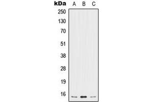Western blot analysis of IL-5 expression in MCF7 (A), SP2/0 (B), H9C2 (C) whole cell lysates. (IL-5 Antikörper  (Center))
