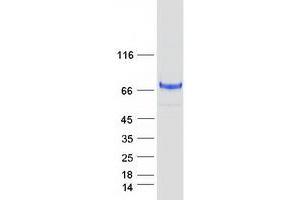 Validation with Western Blot