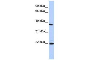 PSMB2 antibody used at 1 ug/ml to detect target protein. (PSMB2 Antikörper)