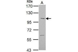 ULK2 anticorps  (C-Term)