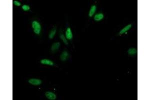 Image no. 4 for anti-Cyclin-Dependent Kinase 2 (CDK2) antibody (ABIN1497394) (CDK2 Antikörper)
