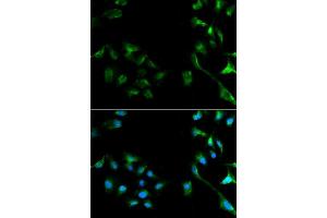 Immunofluorescence analysis of A549 cell using ERK1/2 antibody. (ERK2 Antikörper  (AA 200-300))