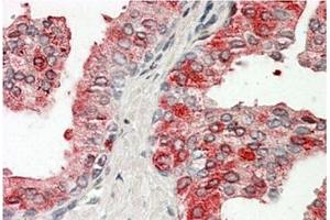 AP20162PU-N ACPP Antibody staining of paraffin embedded Human Prostate at 3. (ACPP Antikörper  (Internal Region))