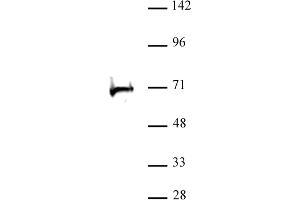 RBBP5 antibody (pAb) tested by Western blot. (RBBP5 Antikörper  (C-Term))