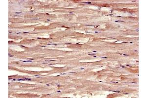 Immunohistochemistry of paraffin-embedded human skeletal muscle tissue using ABIN7171205 at dilution of 1:100 (SYNM Antikörper  (AA 1147-1417))