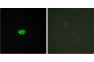 Immunofluorescence analysis of HuvEc cells, using GPR108 Antibody. (GPR108 Antikörper  (AA 155-204))