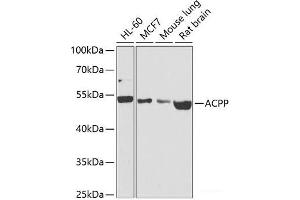 Western blot analysis of extracts of various cell lines using ACPP Polyclonal Antibody at dilution of 1:1000. (ACPP Antikörper)