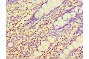 Immunohistochemistry of paraffin-embedded human colon tissue using ABIN7147558 at dilution of 1:100 (CHI3L2 Antikörper  (AA 27-390))
