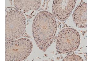 Immunohistochemistry (IHC) image for anti-LIM Domain Kinase 1 (LIMK1) (pThr508) antibody (ABIN6255701)