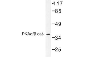 Image no. 1 for anti-Protein Kinase A, alpha (PRKACA) antibody (ABIN317665) (PRKACA Antikörper)