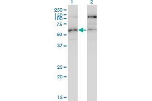 Western Blot analysis of STK38L expression in transfected 293T cell line by STK38L monoclonal antibody (M01), clone 4E5. (STK38L Antikörper  (AA 1-464))