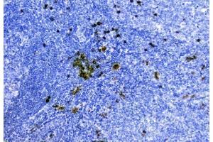 IHC analysis of Hemoglobin using anti-Hemoglobin antibody (ABIN5518839). (HBA1 Antikörper  (AA 2-142))