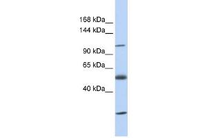SLC39A10 antibody used at 1 ug/ml to detect target protein. (SLC39A10 Antikörper)