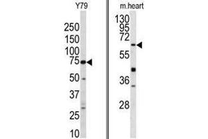 (LEFT) Western blot analysis of GGTLA1 antibody (N-term) in Y79 cell line lysates (35 µg/lane). (GGT5 Antikörper  (N-Term))