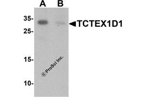 Western Blotting (WB) image for anti-Tctex1 Domain Containing 1 (TCTEX1D1) (N-Term) antibody (ABIN1587947)