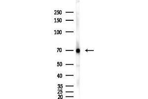 Western blot analysis of lysates from Hela cells(heat-shock,45 min treatment), using Cox1 Antibody at 1/1000 dilution.