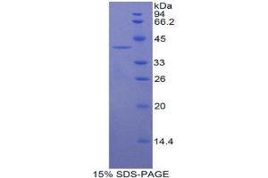 SDS-PAGE (SDS) image for Keratin 16 (KRT16) (AA 117-419) protein (His tag) (ABIN1080129)