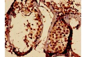 Immunohistochemistry analysis of human testis tissue using ABIN7169803 at dilution of 1:100 (SLITRK5 Antikörper  (AA 617-890))