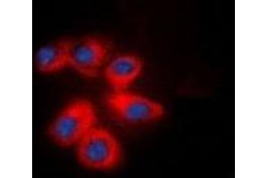 Immunofluorescent analysis of CD29 staining in NIH3T3 cells. (ITGB1 Antikörper  (C-Term))