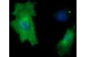 Image no. 4 for anti-Cancer/testis Antigen 1B (CTAG1B) antibody (ABIN1499892) (CTAG1B Antikörper)