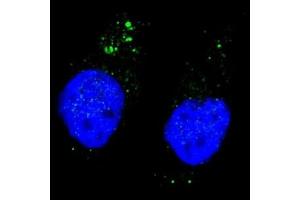 Fluorescent image of Chloroquine treated U251 cells stained with phospho-ULK1 antibody at 1:200. (ULK1 Antikörper  (pSer556))