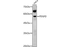 Western blot analysis of extracts of various cell lines, using PDGFD antibody (ABIN7269393) at 1:1000 dilution.