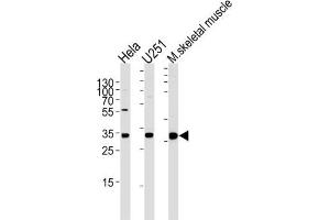 Western Blotting (WB) image for anti-Polymerase (RNA) II (DNA Directed) Polypeptide C, 33kDa (POLR2C) antibody (ABIN5025249) (POLR2C Antikörper)
