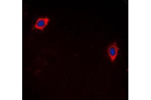 Immunofluorescent analysis of GHRH Receptor staining in LOVO cells.