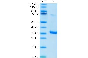 HMGB1 Protein (AA 1-215) (His tag)