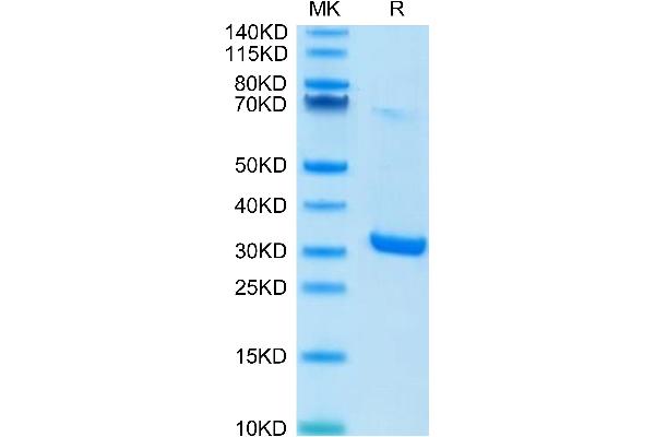 HMGB1 Protein (AA 1-215) (His tag)