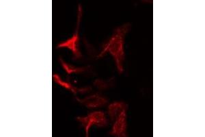 ABIN6275023 staining Hela cells by IF/ICC. (COPZ1 Antikörper  (N-Term))