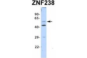 Host:  Rabbit  Target Name:  ZNF238  Sample Type:  Human Fetal Pancreas  Antibody Dilution:  1. (ZNF238 Antikörper  (N-Term))