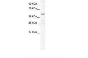 Image no. 2 for anti-YY1 Transcription Factor (YY1) (AA 274-323) antibody (ABIN6735976) (YY1 Antikörper  (AA 274-323))