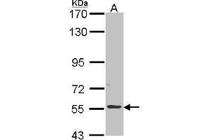 ALPPL2 Antikörper  (Center)