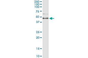 Immunoprecipitation of SPHK1 transfected lysate using anti-SPHK1 monoclonal antibody and Protein A Magnetic Bead , and immunoblotted with SPHK1 MaxPab rabbit polyclonal antibody. (SPHK1 Antikörper  (AA 1-384))