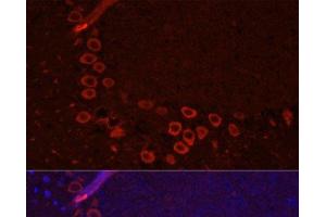 Immunofluorescence analysis of Mouse brain using SLC1A1 Polyclonal Antibody at dilution of 1:100. (SLC1A1 Antikörper)