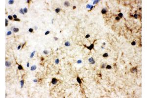 Anti-HSF2 antibody, IHC(P) IHC(P): Rat Brain Tissue (HSF2 Antikörper  (Middle Region))