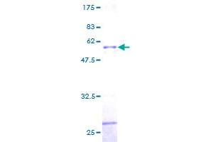 PPP6C Protein (AA 1-305) (GST tag)