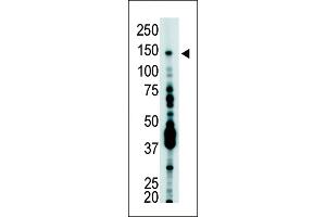 Antibody is used in Western blot to detect USP7 in T-47D cell lysate. (USP7 Antikörper  (C-Term))