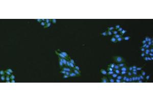Immunofluorescence analysis of hepG2 cell using VNN1 Polyclonal Antibody at dilution of 1:100 (VNN1 Antikörper)