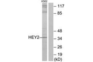 Western blot analysis of extracts from K562 cells, using HEY2 Antibody. (HEY2 Antikörper  (AA 21-70))