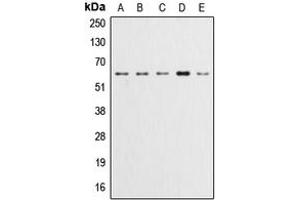 Western blot analysis of AKT (pY315) expression in HeLa (A), A549 (B), LOVO (C), HepG2 (D), NIH3T3 (E) whole cell lysates. (AKT1 Antikörper  (pTyr315))