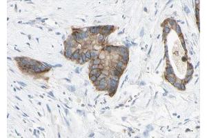 ABIN6268761 at 1/100 staining human liver tissue sections by IHC-P. (Claudin 6 Antikörper  (Internal Region))