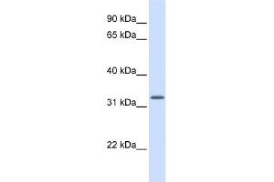WB Suggested Anti-MRPS15 Antibody Titration: 0. (MRPS15 Antikörper  (Middle Region))