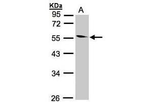 WB Image Sample(30 ug whole cell lysate) A:293T 10% SDS PAGE antibody diluted at 1:1000 (CORO1B Antikörper)