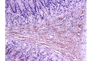 Immunohistochemistry (IHC) image for anti-Collagen, Type I (COL1) (AA 1321-1400) antibody (ABIN670386)