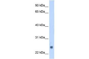 Troponin I Type 2 antibody used at 1.