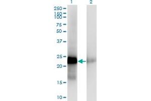 Western Blotting (WB) image for anti-Cbp/p300-Interacting Transactivator, with Glu/Asp-Rich Carboxy-terminal Domain, 1 (CITED1) (AA 94-193) antibody (ABIN518016)