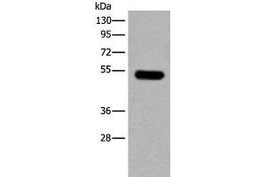 Western blot analysis of Mouse brain tissue lysate using CDKL2 Polyclonal Antibody at dilution of 1:250 (CDKL2 Antikörper)